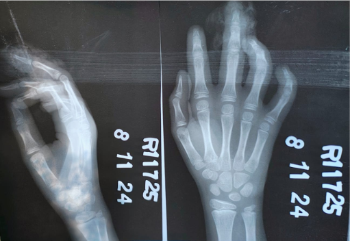 Doctor reviewing hand x-ray