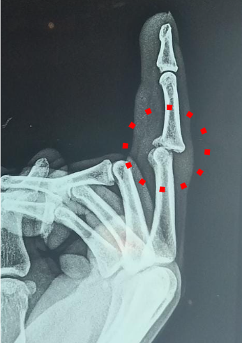 PIP Joint Reference